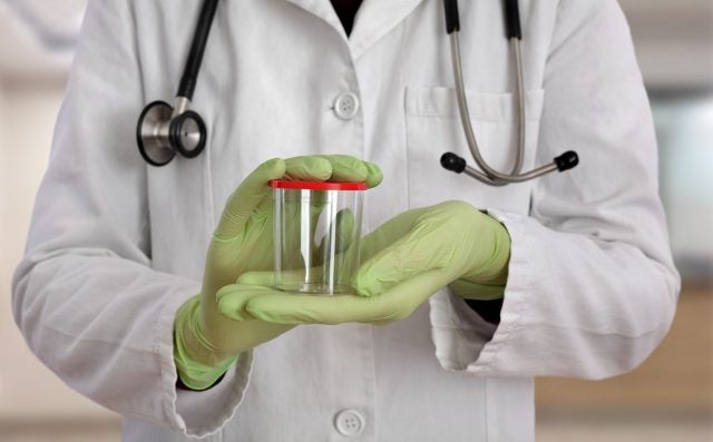 drug testing
